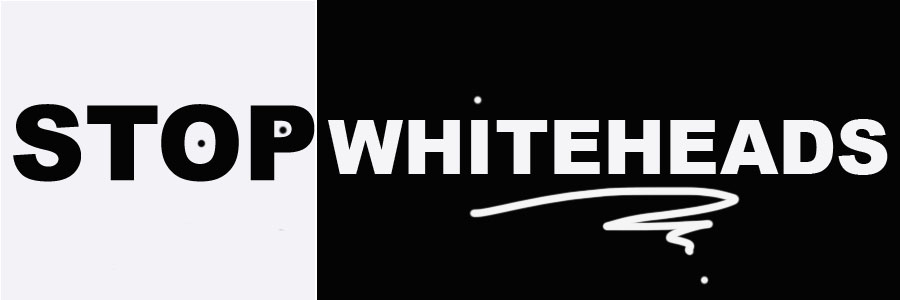 Stop Whiteheads